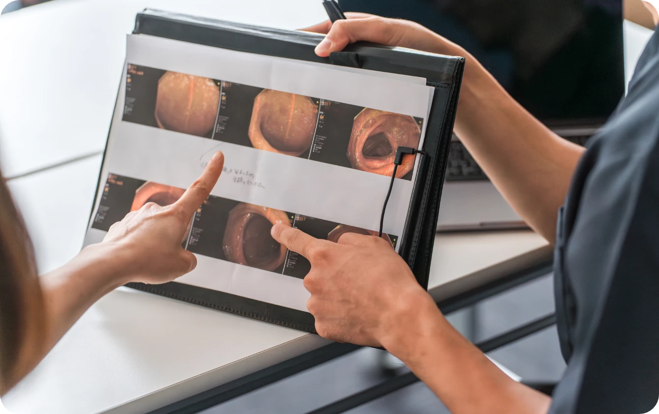 便潜血検査で陽性の場合は放置してはいけませんイメージ